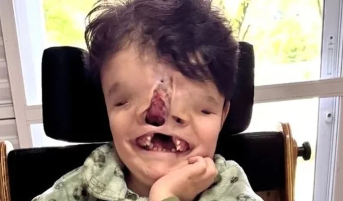 AJUDE O GUERREIRO JOAQUIM VIVER SEM DOR