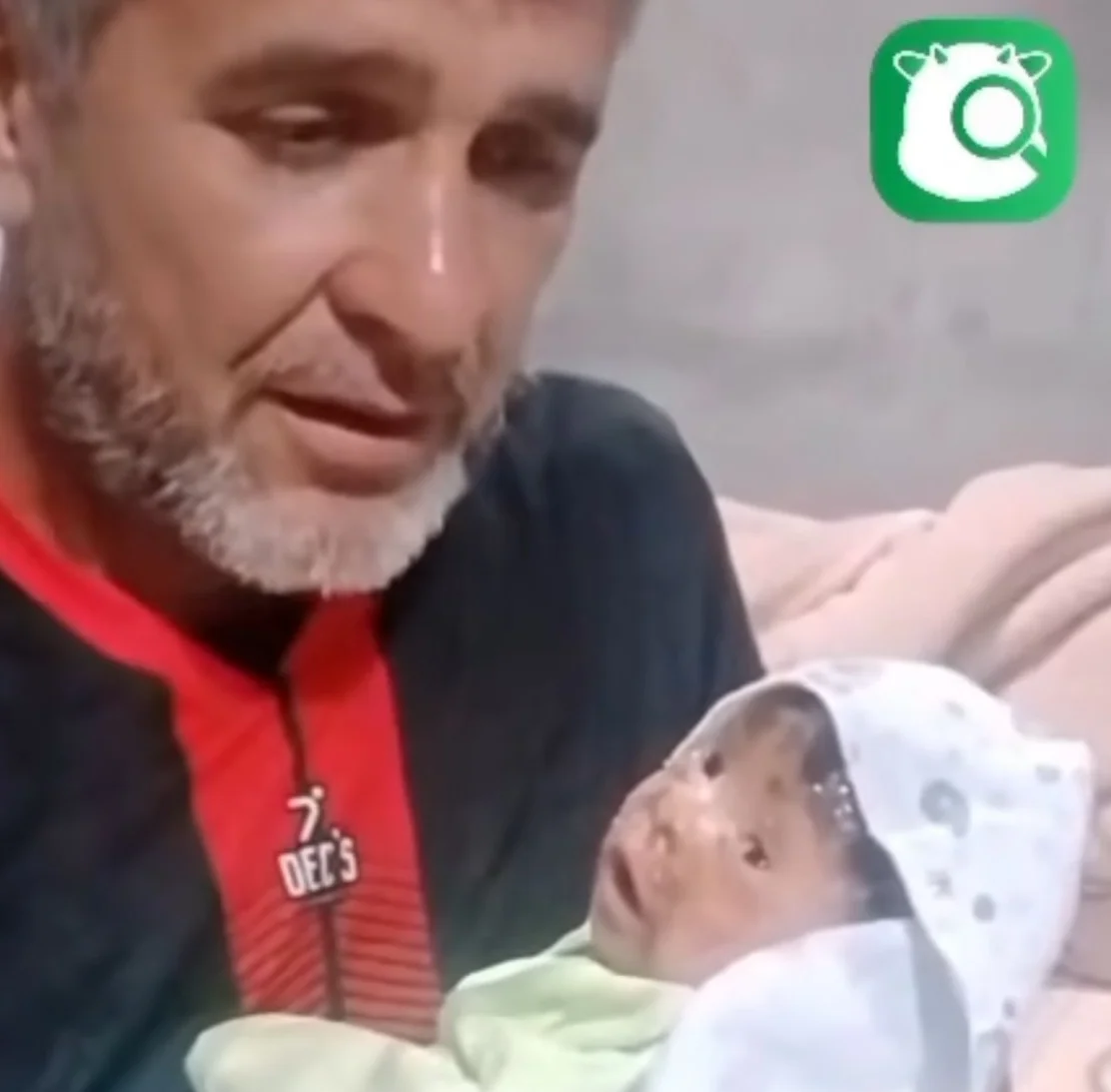 Ajude o pequeno João, recém-nascido com ictiose, a não sentir dor todos os dias